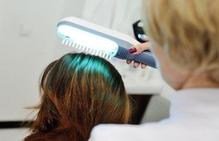 علاج الصلع بالليزر | ليزر لتنشيط بصيلات الشعر اخصائية الجراحة التجميلية | الدكتورة ليلى آرفاس علاج الصلع بالليزر علاج الصلع بالليزر | ليزر لتنشيط بصيلات الشعر اخصائية الجراحة التجميلية | الدكتورة ليلى آرفاس علاج الصلع بالليزر